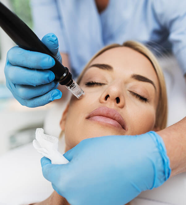 Woman getting Microneedling procedure to her upper cheek