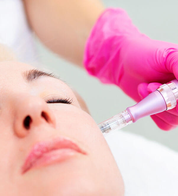Woman receiving Microneedling procedure on her face