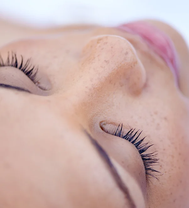 Woman getting chemical peel applied